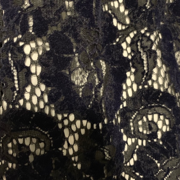 Tory Burch - Velvet and Lace mini dress - Picture 3 of 4